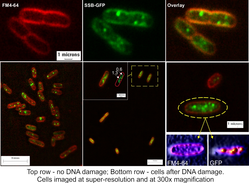 SUper-resolution imaging of cells