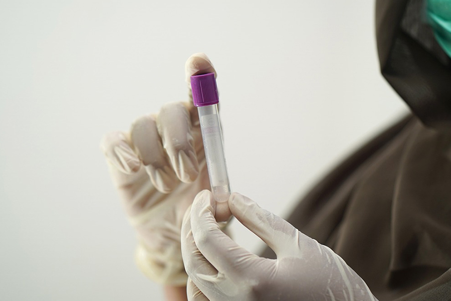 Lab professional holding test tube