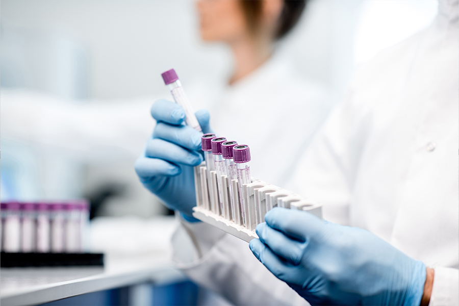 Laboratory assistant putting test tubes into the holder