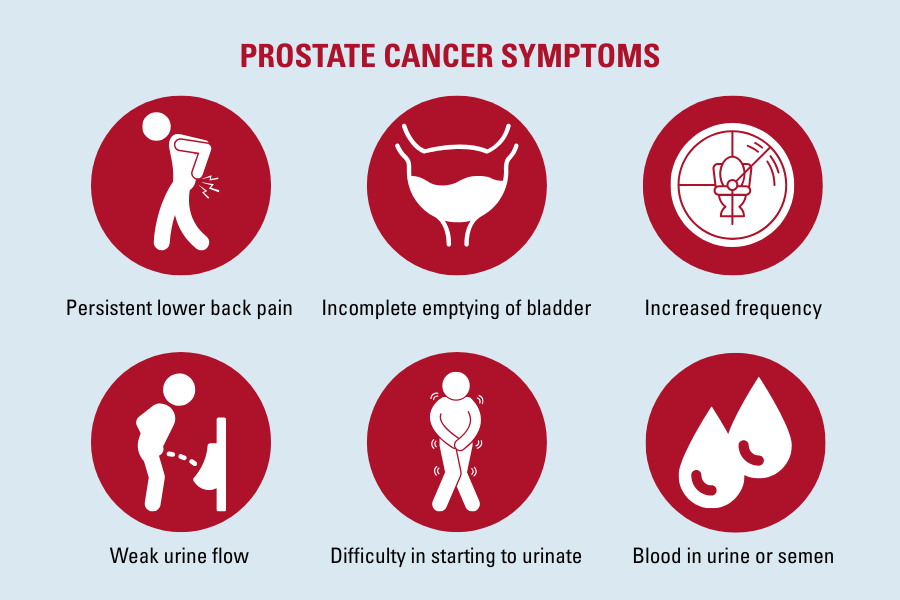 Prostate cancer symptoms 