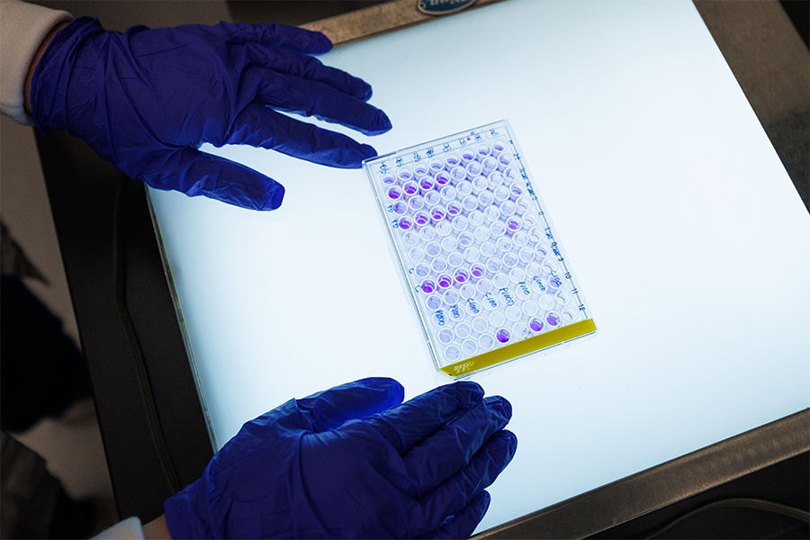 Gloved hands handle a container of lab specimens on a light table.