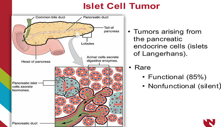 Pancreatic islet cell tumor