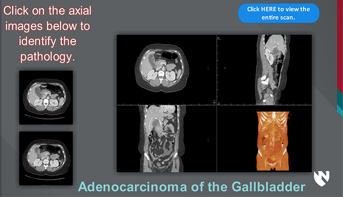 Anatomy of the Female Breast, E-Gallery