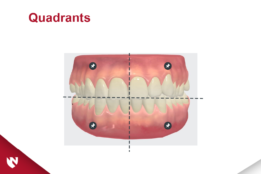Module screenshot showing multiple types of teeth