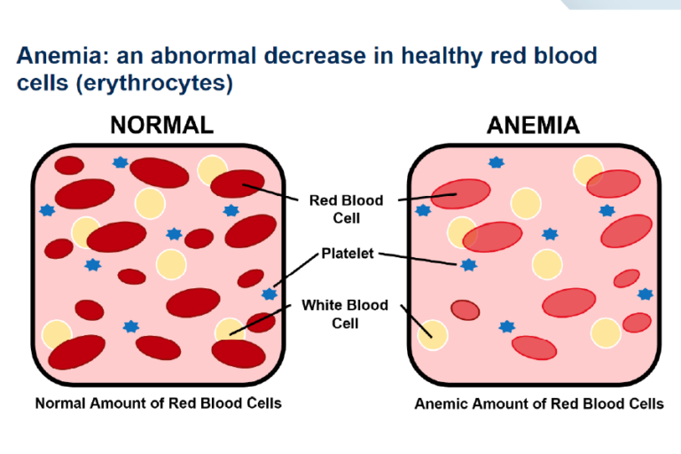Blood Cells Part 3 Pathology Basics EGallery University of