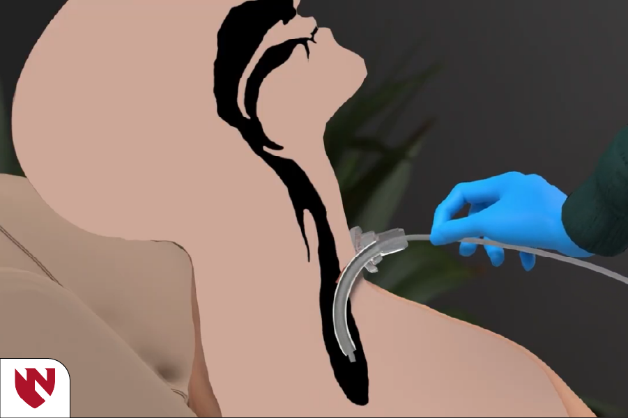 Module screenshot of a tracheostomy suction