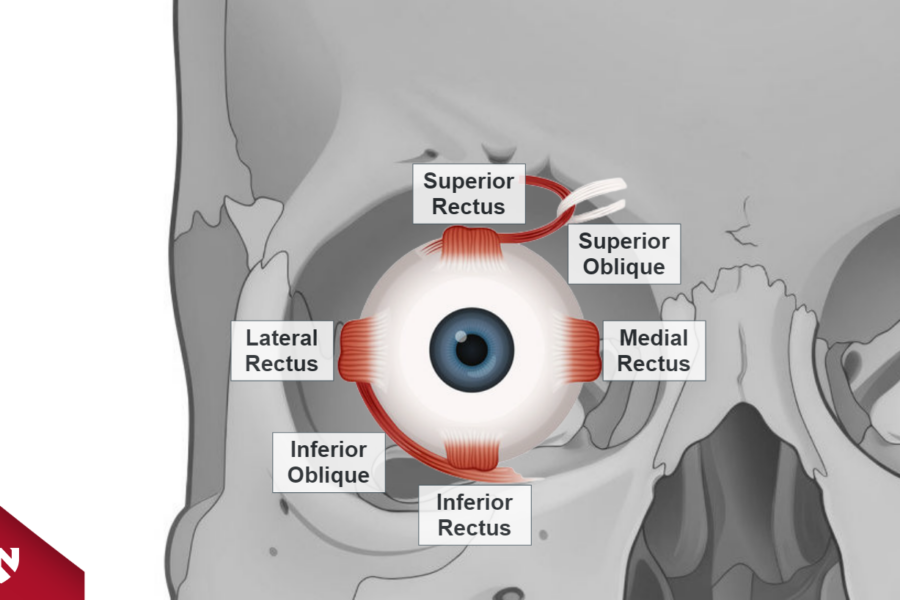 Module screenshot showing a front view of the right eye within the eye socket, highlighting the six extraocular muscles