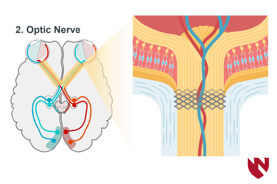Module screenshot showing illustrations of the optic nerve