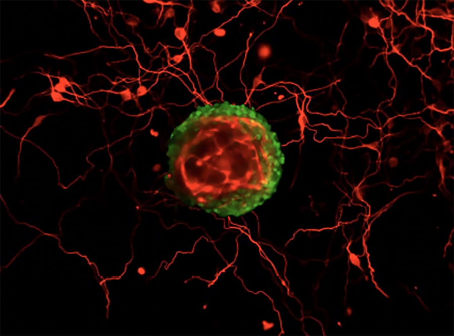 regenerative medicine for the retina
