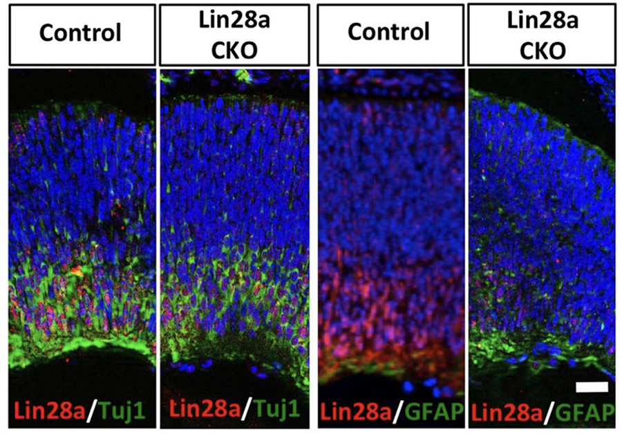 Graphic showing that conditional knock out of Lin28 during early histogenesis decreases neurogenesis (Tuj1+ cells) and leads to premature gliogenesis (GFAP+ cells).