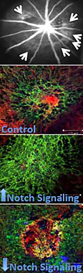 This figure shows laser-induced CNV lesions, their volume decreasing with the activation of Notch signaling.
