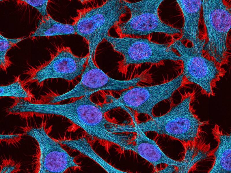 Hela Cells