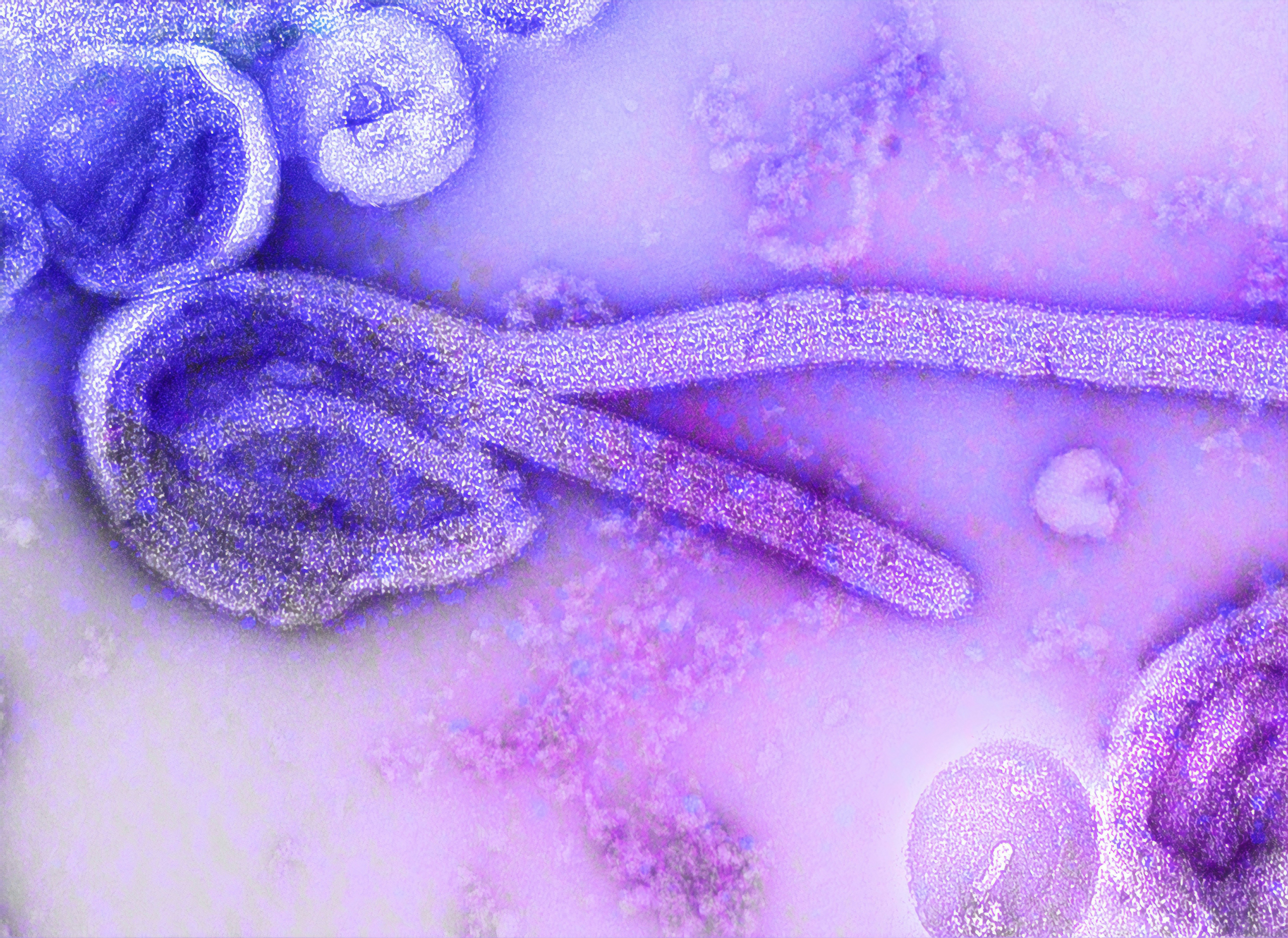 ebolavirus.jpg