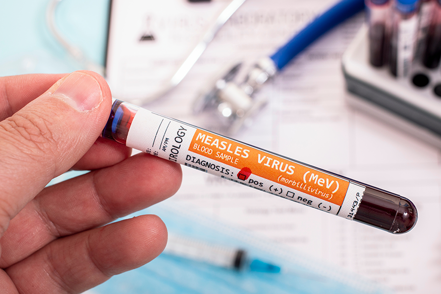 Hand holding a blood sample tube labeled “Measles Virus (MEV)” with medical supplies in the background.