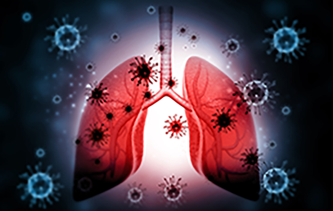 Lung with viruses 