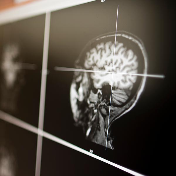 Medical scan of a human skull and brain