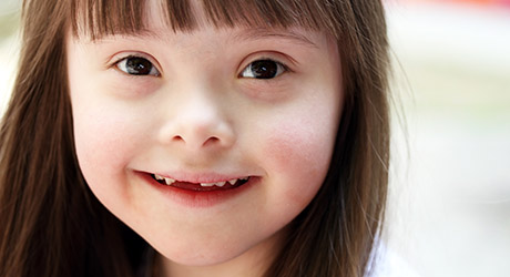 stock photo of young child with a disability looking at the camera, showing teeth, through a slight smile; credit: Adobe stock