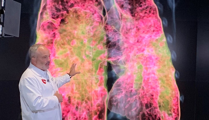 James Lawler, MD, uses video animation developed at UNMC's Interprofessional Experiential Center for Enduring Learning to show how the COVID-19 Delta variant attacks cells and affects patients' lungs.
