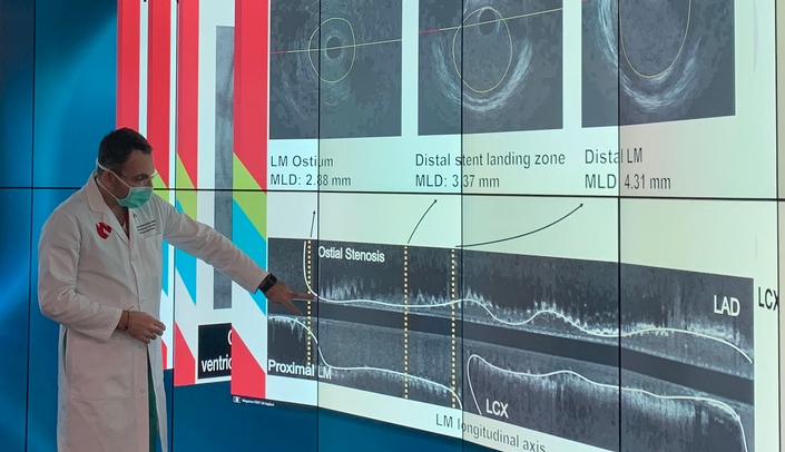 Using the power of the DGX A100 super computer, Yiannis Chatzizisis, MD, PhD, examines patient-specific computer simulations of coronary artery stenting procedures on the touch screens at the Davis Global Center.