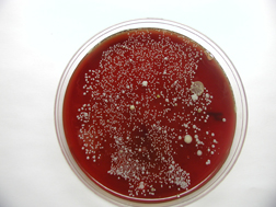 Microbes