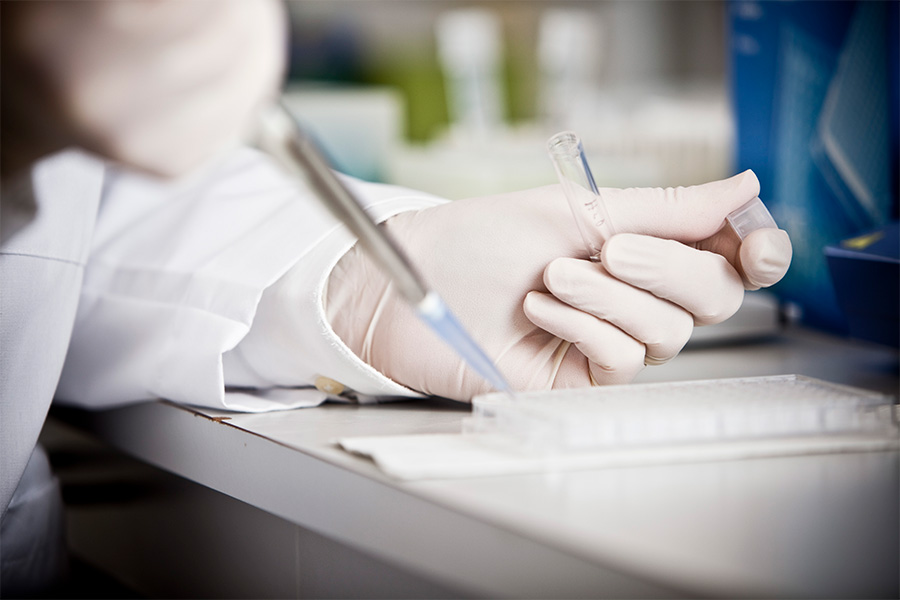 Researcher pipetting sample