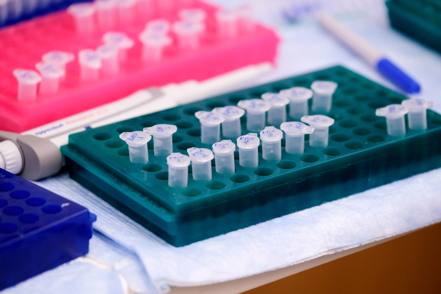close up on pipette lab equipment