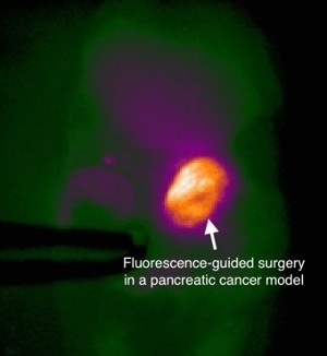 Fluorescence-guided surgery