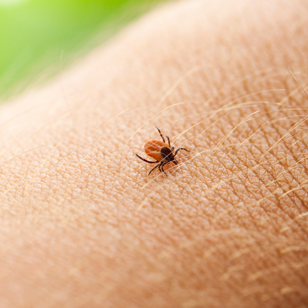 A single tick (bug) crawls across the skin of a person.