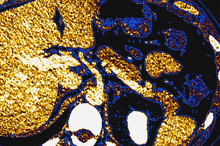 Body imaging scan