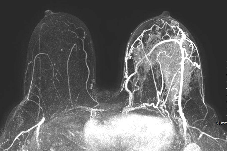 Breast imaging photo