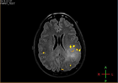 fMRI Figure 1