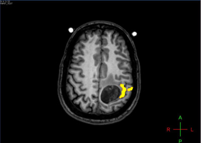 fMRI Figure 2