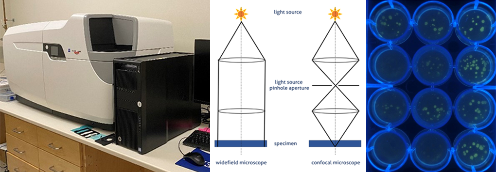 Equipment setup within the core, visualization of the pinhole principle of confocal microscopy versus standard widefield microscopes, representative images of scans captured by this instrument. Diagram from Sandbio (https://www.sanbio.nl/resources/blogs/how-to-choose-the-right-microscope-setup-for-your-experiment) and representative image from Kurebayashi et al. 2016 (Fig. 4) - http://dx.doi.org/10.1371/journal.pone.0156400