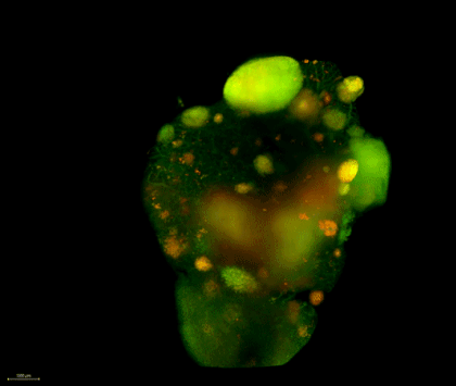 Representative animation of metastatic tumors in murine lung, provided by Grinu Matthews