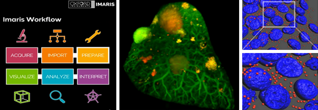 Multi-image collage: Flowchart of Imaris workflow (Acquire, Import, Prepare, Visualize, Analyze, Interpret); Representative 3D-reconstructed images of lung sample with green, red, and blue fluorescence to denote locations of specific proteins. 
